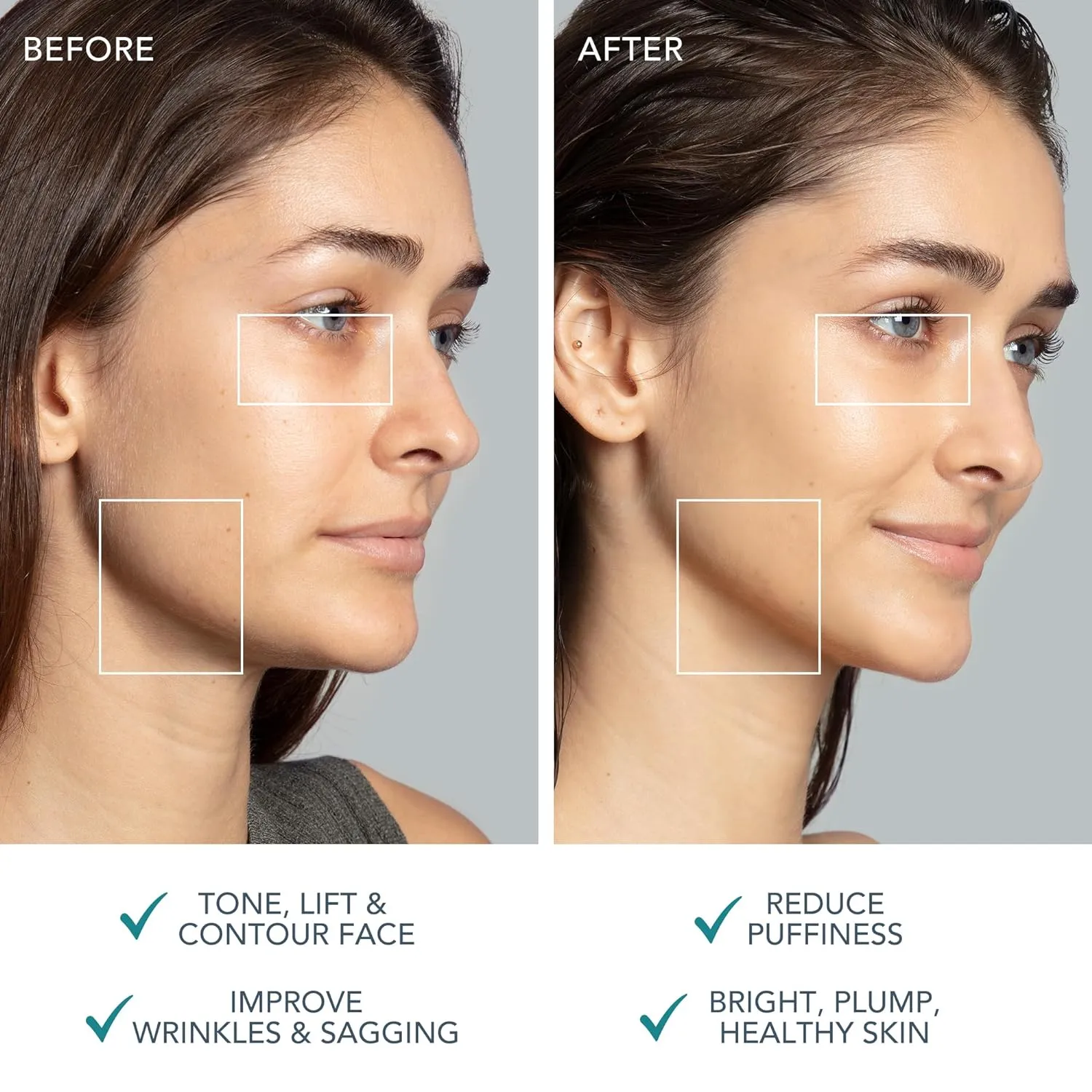 FOREO BEAR 2 - Microcurrent Facial Device